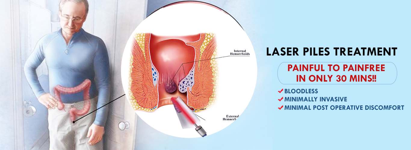 laser clinic India