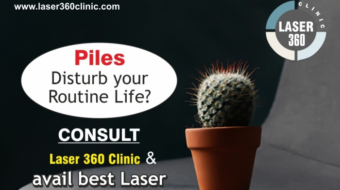 laser treatment for piles ncr