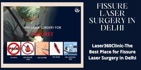 fissure laser surgery in delhi