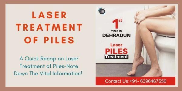 laser treatment of piles