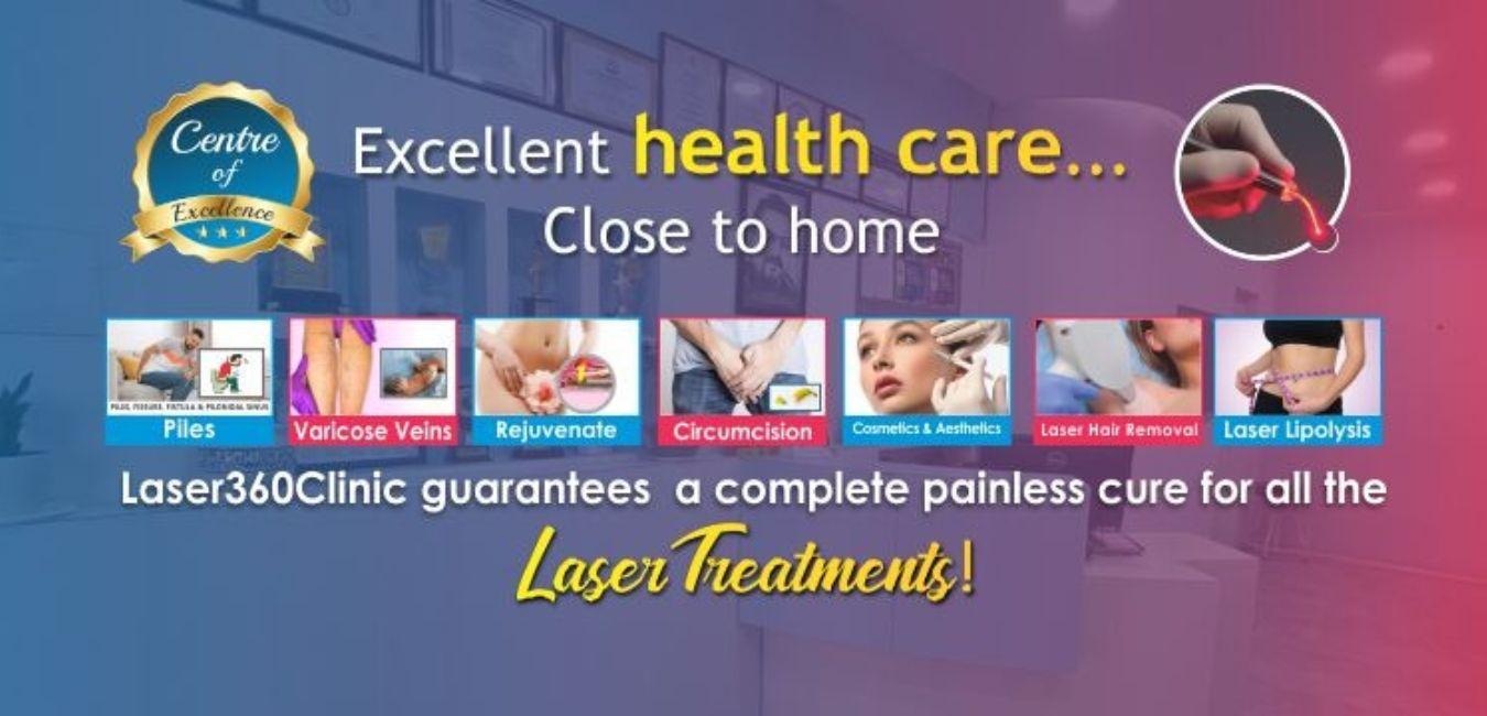 Laser Piles Treatment