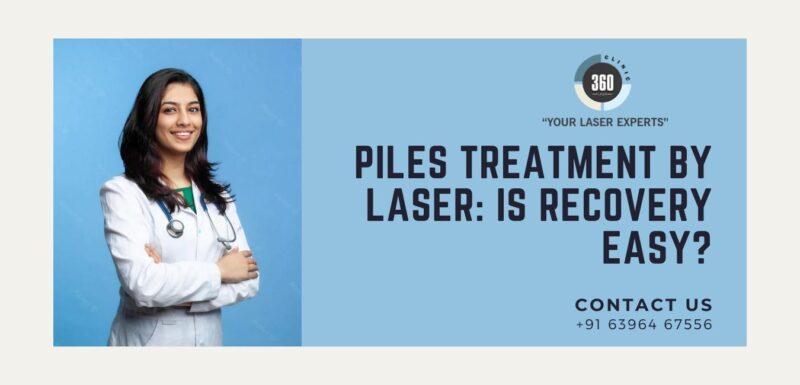 Piles Treatment By Laser: Is Recovery Easy? – Laser360clinic.com